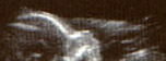 ultrasound scan of child in womb